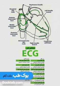 سفر در ECG