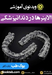 ویدئوی آموزشی الاینرها در دندانپزشکی