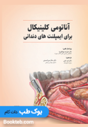 آناتومی کلینیکال برای ایمپلنت های دندانی