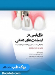 بازاریابی در ایمپلنت های دندانی چگونگی ترغیب بیماران برای انجام درمان های ایمپلنت