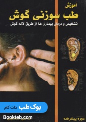 آموزش طب سوزنی گوش تشخیص و درمان بیماری ها از طریق لاله گوش 