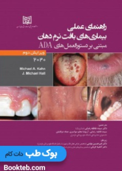 oral_soft_tissue_diseases