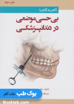 step_by_step_with_local_anesthesia_in_dentistry