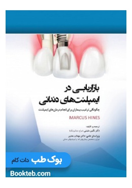 marketing_in_dental_implants_how_to_persuade_patients_to_do_implant_treatments