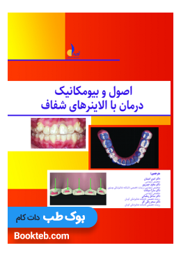 principles_and_biomechanics_of_treatment_with_transparent_aligners