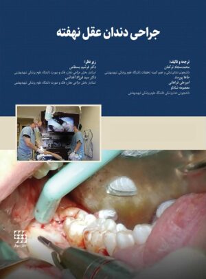 جراحی دندان عقل نهفته شایان نمودار