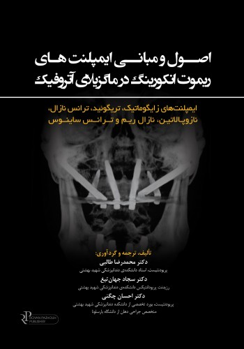 اصول و مبانی ایمپلنت های ریموت انکورینگ در ماگزیلای آتروفیک