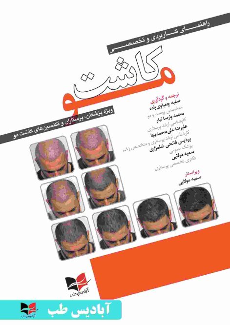 راهنمای کاربردی و تخصصی کاشت مو